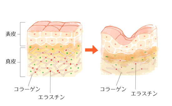 年齢がばれる 隠しづらい首のシワを消す方法と予防策 女性の美学