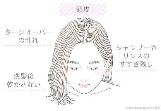 頭皮に吹き出物ができる原因